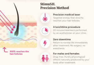 The StimuSIL Precision Method is a lunchtime medical laser procedure with no downtime that's for male and female hair loss